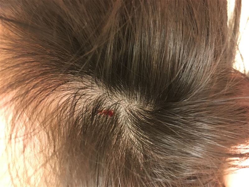 猫,噛みつく,飛びつく